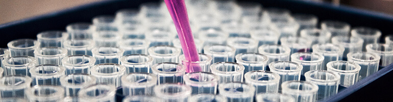 Biotech Aktien kaufen